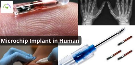 rfid chip refusal|microchip implants banned.